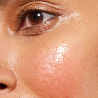 Een extreme close-up van het midden van het gezicht, met focus op de wang en het gebied onder het oog. De huid heeft een gehydrateerde, dauwachtige uitstraling met een opvallende, plaatselijke roze blos en lichte irritatie in het midden van de wang.