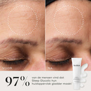 Close-up van het voorhoofd van een deelnemer voor en na gebruik, wat een zichtbaar gladdere huidstructuur en verfijnde uitstraling laat zien. In de hoek staan de Medik8 Sleep Glycolic tube en een textuurveeg. Tekst: "97% vond dat Sleep Glycolic hun huidoppervlak gladder maakte*."