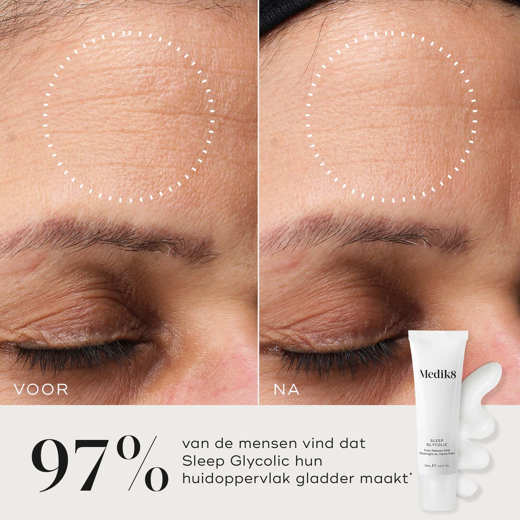Close-up van het voorhoofd van een deelnemer voor en na gebruik, wat een zichtbaar gladdere huidstructuur en verfijnde uitstraling laat zien. In de hoek staan de Medik8 Sleep Glycolic tube en een textuurveeg. Tekst: "97% vond dat Sleep Glycolic hun huidoppervlak gladder maakte*."