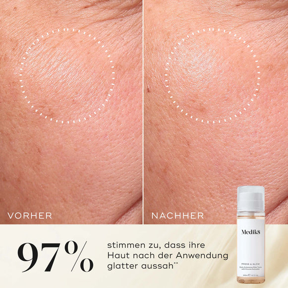 Nahaufnahme der Wange einer Teilnehmerin vor und nach der Anwendung, die eine glattere Textur und ein gleichmäßigeres Erscheinungsbild zeigt. Die Medik8 Press & Glow-Tonikflasche ist in der Ecke zu sehen. Der Text hebt hervor: „97 % stimmen zu, dass ihre Haut nach der Anwendung glatter aussah.“-hover-45