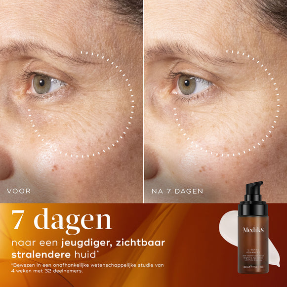 Voor- en na-vergelijking van de huid van een deelnemer over 7 dagen, waarbij zichtbaar helderdere huid met verbeterde uitstraling en een egalere teint wordt getoond.
Voor- en na-close-up van de huid van een deelnemer over 7 dagen, die een zichtbaar gladdere huidtextuur en verfijnde uitstraling laat zien.-hover-3