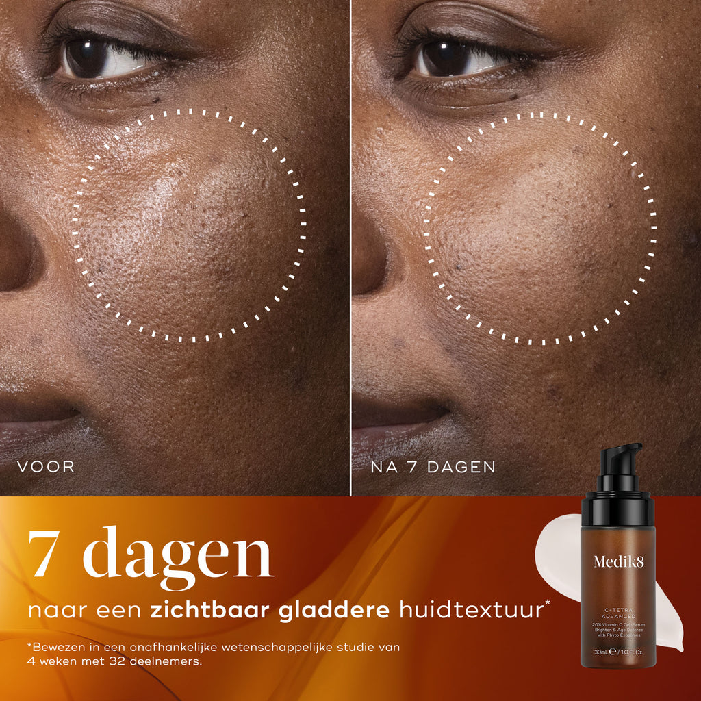 Voor- en na-vergelijking van de huid van een deelnemer over 7 dagen, waarbij zichtbaar helderdere huid met verbeterde uitstraling en een egalere teint wordt getoond.
Voor- en na-close-up van de huid van een deelnemer over 7 dagen, die een zichtbaar gladdere huidtextuur en verfijnde uitstraling laat zien.