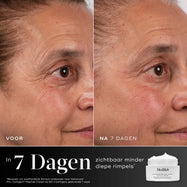 Voor- en na-vergelijking van het ooggebied van een deelnemer over 7 dagen, weergegeven naast de pot van Medik8 Advanced Pro-Collagen+ Peptide Cream. Tekst benadrukt dat het product bewezen is om de diepte van rimpels zichtbaar te verminderen binnen 7 dagen.