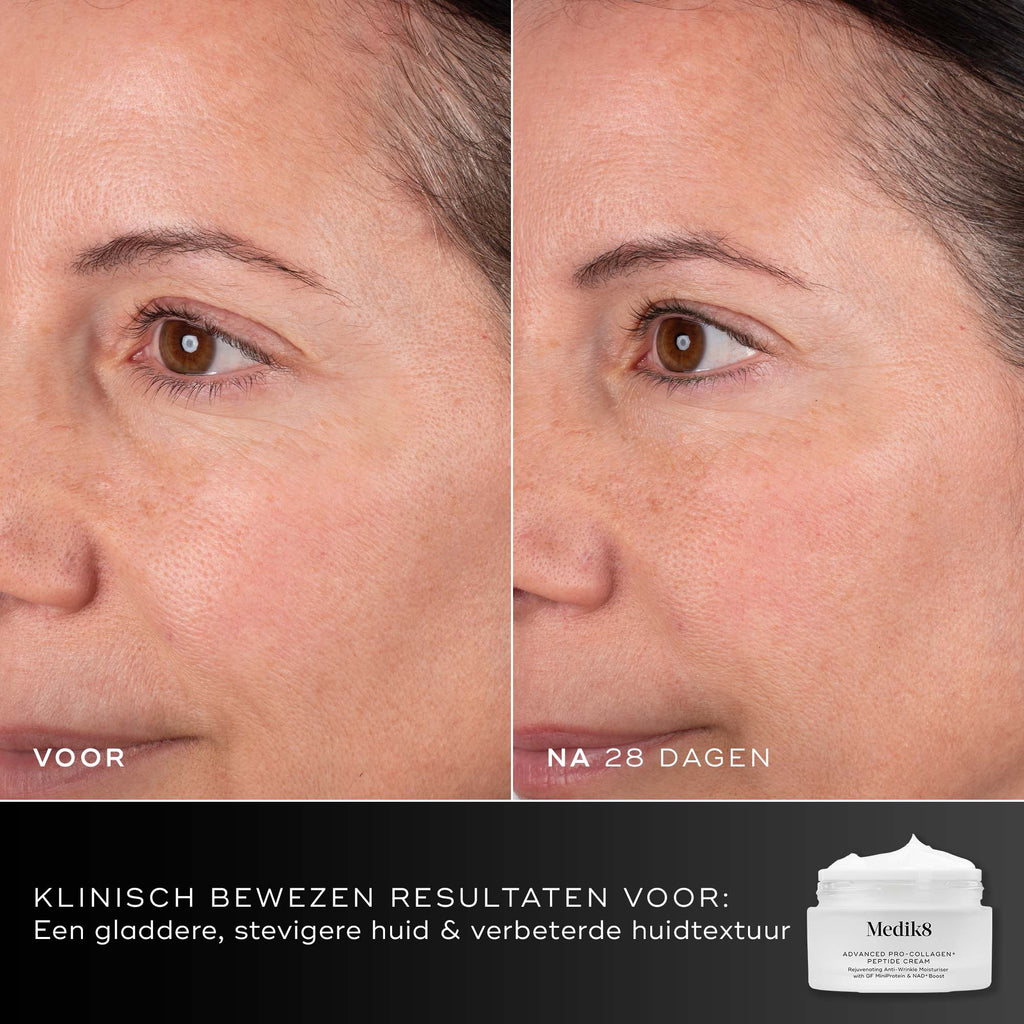 Voor- en na-vergelijking van het gezicht van een deelnemer over 28 dagen, weergegeven naast de pot van Medik8 Advanced Pro-Collagen+ Peptide Cream. Tekst benadrukt klinisch bewezen resultaten op het gebied van gladheid, stevigheid en huidtextuur.