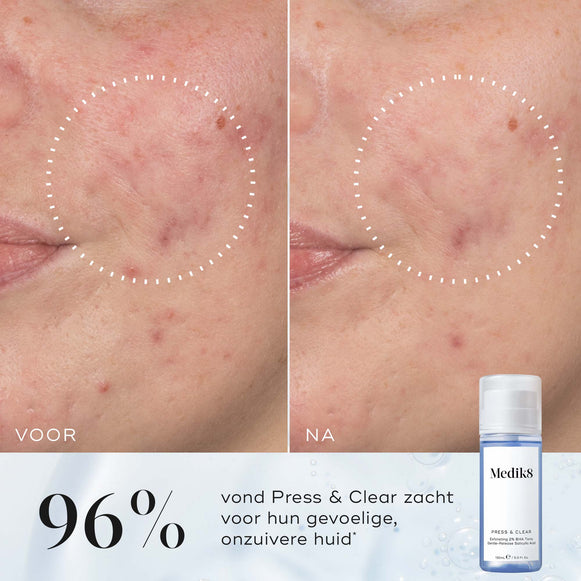 Press & Clear™ hover