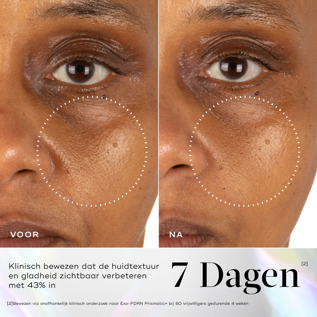Voor- en nafoto’s van de huid rond de ogen met verbeterde huidvitaliteit en luminositeit na 7 dagen gebruik van Medik8 Exo-PDRN Prismatic+.